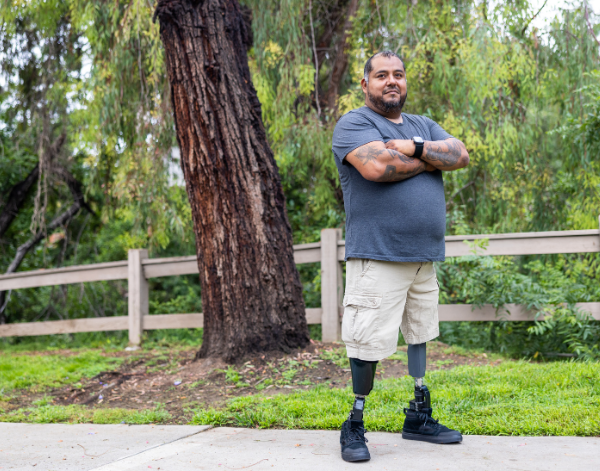 Man with prosthetic legs smiling outside.