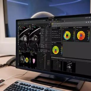 Philips Advanced Visualization & AI